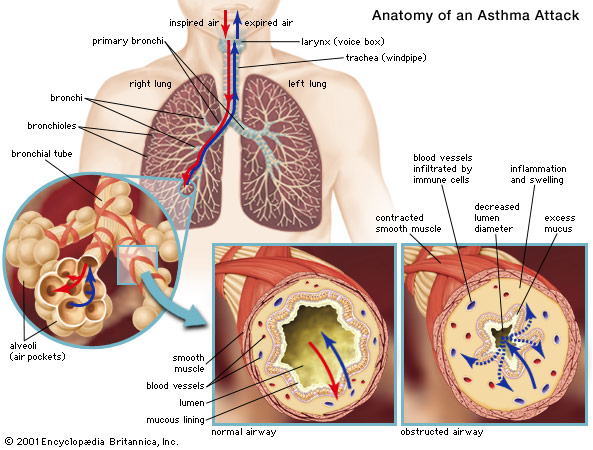 http://bukusakudokter.files.wordpress.com/2012/10/bronchial-asthma.jpg